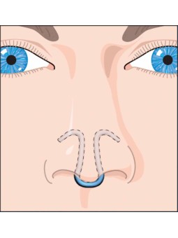 Stimulateur circulatoire...