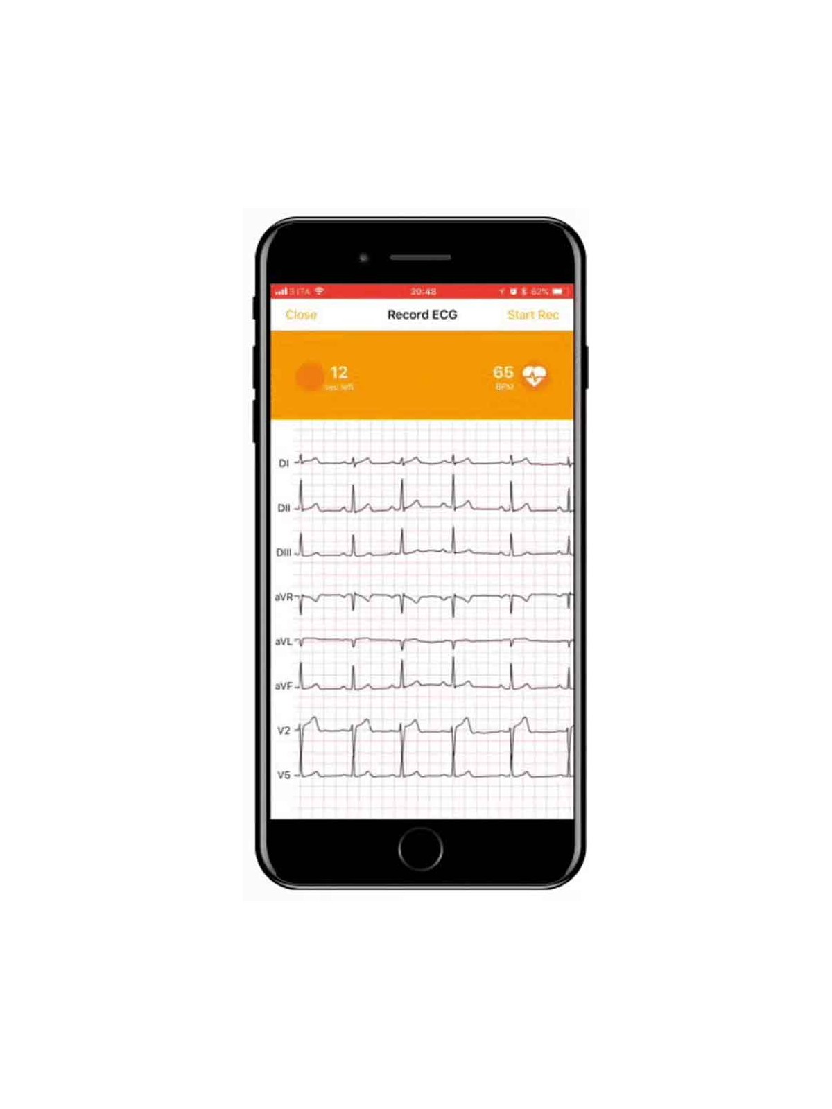ECG connecté