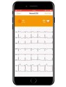 ECG connecté